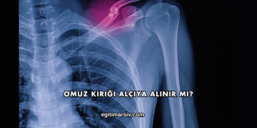 Omuz Kırığı Alçıya Alınır mı?