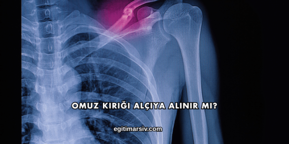 Omuz Kırığı Alçıya Alınır mı?