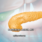 Pankreas Alınır mı?