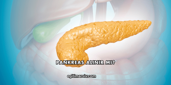 Pankreas Alınır mı?